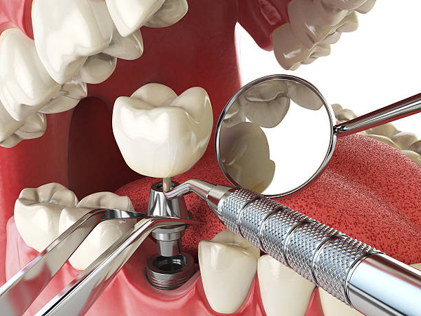 Best Emergency Dental Surgery in Bayshe, OR